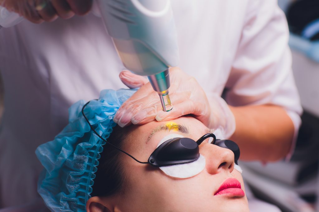 xóa xăm chân mày bằng laser